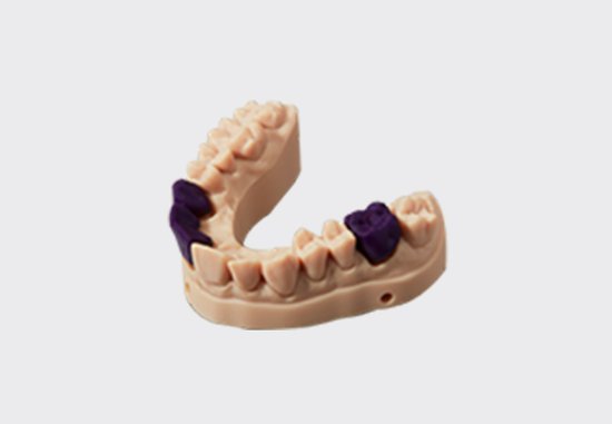 Dental Casting Resin